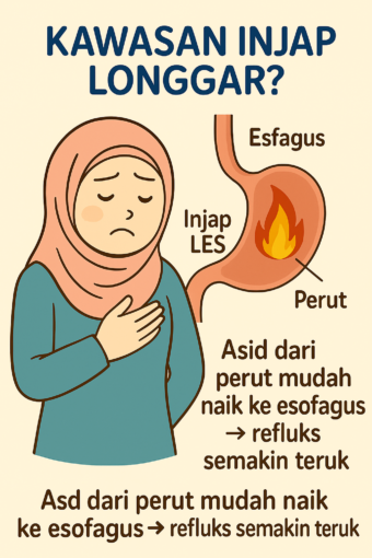 elak gerd waktu mengandung