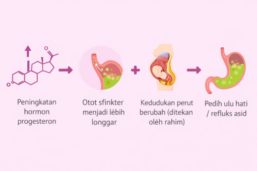 punca gerd semasa mengandung